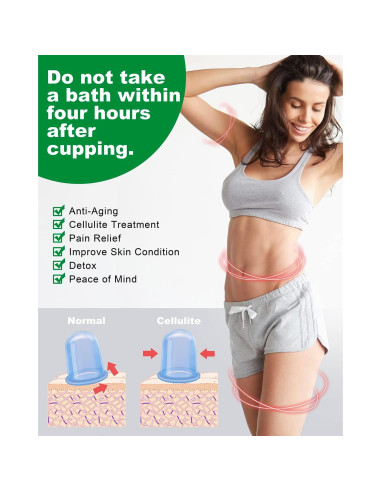 Conjunto de Ventosas de Silicona SHKIBY Anticelulitis