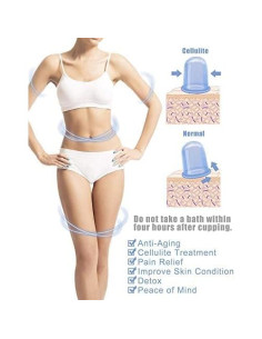 Conjunto de Ventosas de Silicona Soluxus 4 Piezas Anticelulitis 2