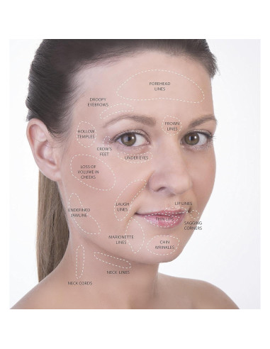 Kit de Ventosas Faciales y Corporales SanDine - 4 Piezas