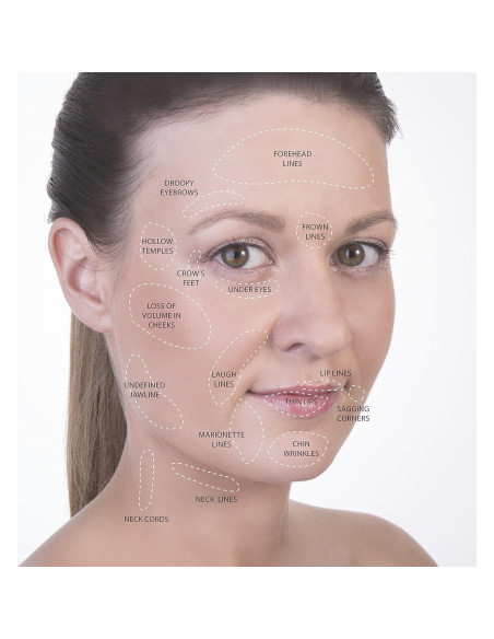 Kit de Ventosas Faciales y Corporales SanDine - 4 Piezas