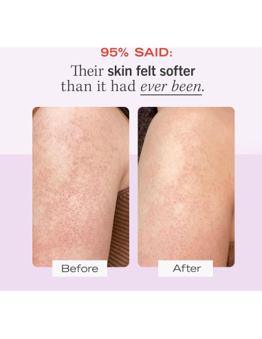 Exfoliante Corporal First Aid Beauty KP Bump Eraser 113 g