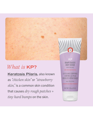 Exfoliante Corporal First Aid Beauty KP Bump Eraser 113 g