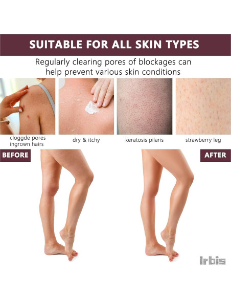 Guante Exfoliante Corporal Irbis - Mitón Doble Textura 27.4cm