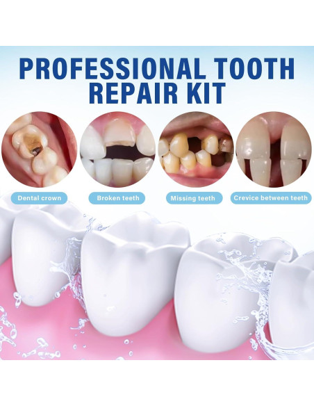 Kit de Cemento de Óxido de Zinc-Eugenol HUFLYI 15g + 10ml