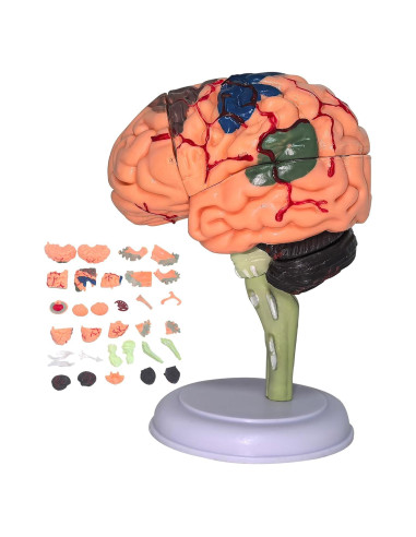 Modelo Anatómico de Cerebro Humano Mini XDKHAEA 31 Piezas