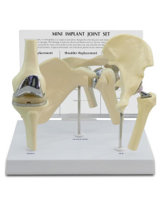 Set de Articulaciones Mini Implant GPI Anatomicals 3 Piezas