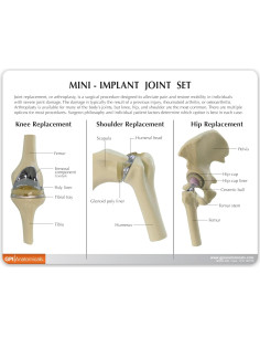 Set de Articulaciones Mini Implant GPI Anatomicals 3 Piezas 2