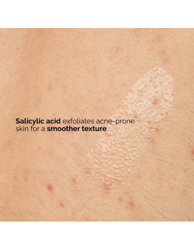 El Ordinario Suero Corporal Ácido Salicílico 0.5% 240 ml