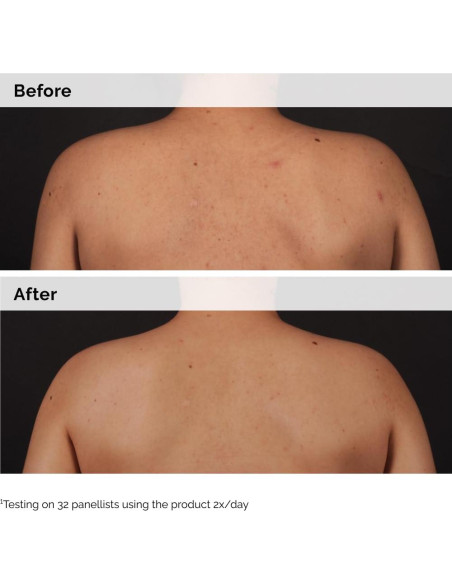 El Ordinario Suero Corporal Ácido Salicílico 0.5% 240 ml