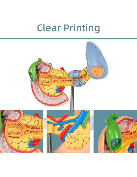 Modelo Anatómico del Páncreas y Bazo Simedutech - Educativo