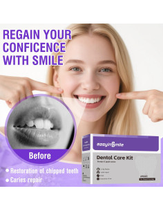 Kit de Reparación Dental Temporal Jinestune - 10g Polvo + 6ml Líquido 2