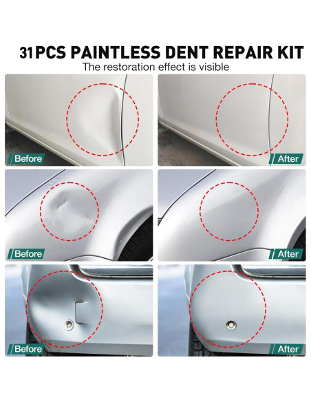 Kit de 31 Piezas para Sacar Abolladuras NJ FOREVER K2-3