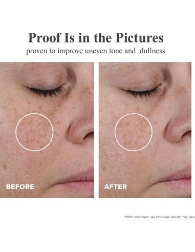 Cápsulas Suero Corrector de Manchas HKH Triple Vitamina C 40g