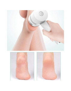 Removedor de Callos Eléctrico Cimenn NV8615D con Batería 2000mAh 2