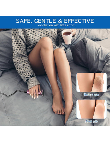 Removedor de Callos Eléctrico Dermave con 60 Discos de Lija