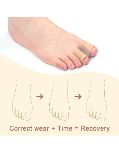 Separadores de Dedos de Gel Gosknor - 4 Piezas, Alineadores Elásticos