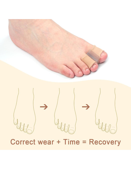 Separadores de Dedos de Gel Gosknor - 4 Piezas, Alineadores Elásticos