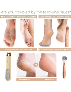 Lima de Pies Doble Cara con 21 Cuchillas - Removedor de Callos 2