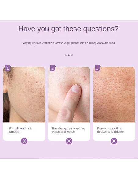 Rodillo de Hielo Facial KERYALELA 2 en 1 para Mujeres