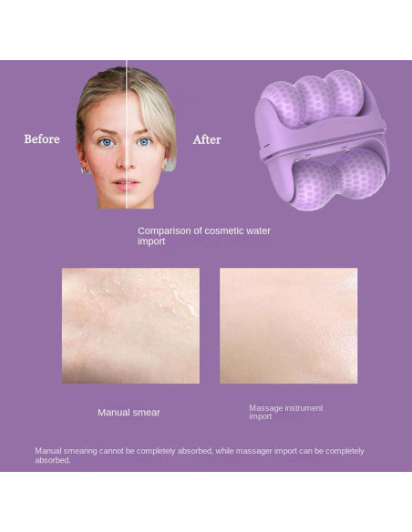 Rodillo de Hielo Facial KERYALELA 2 en 1 para Mujeres