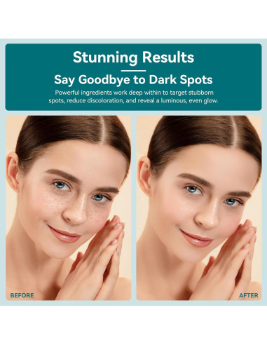 Removedor de Manchas Oscuras UFEEK con Bola de Masaje 360