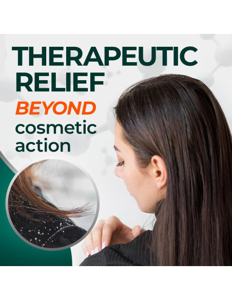 Champú Anticaspa Medicasp 177 ml con Alquitrán de Hulla