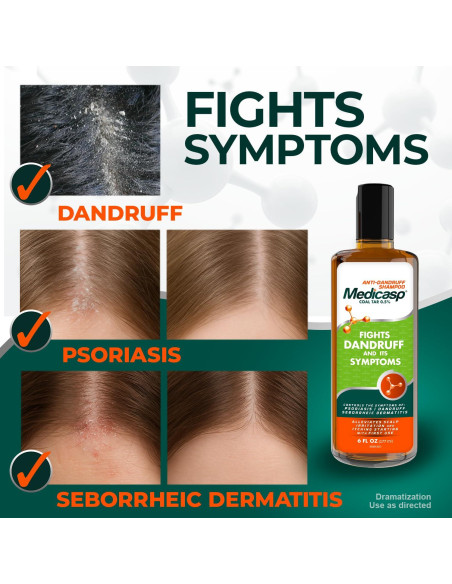 Champú Anticaspa Medicasp 177 ml con Alquitrán de Hulla