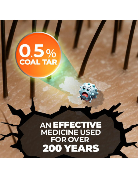 Champú Anticaspa Medicasp 177 ml con Alquitrán de Hulla