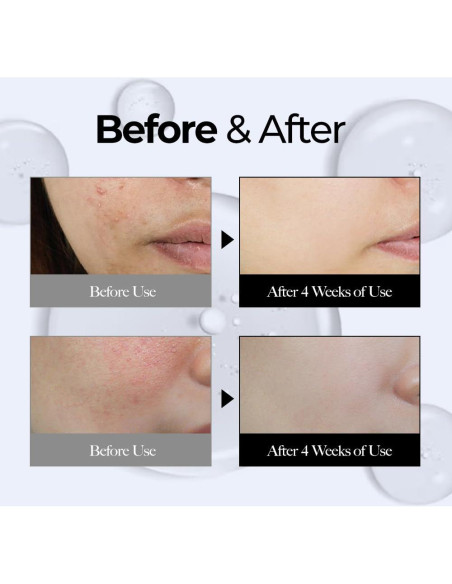 Suero Facial Hyclair 100 ml - Ácido Hialurónico Triple 10 Especies