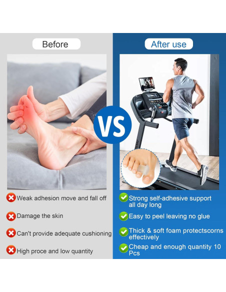 Separadores de Dedos de Silicona Viexpand - 10 Pcs para Juanetes