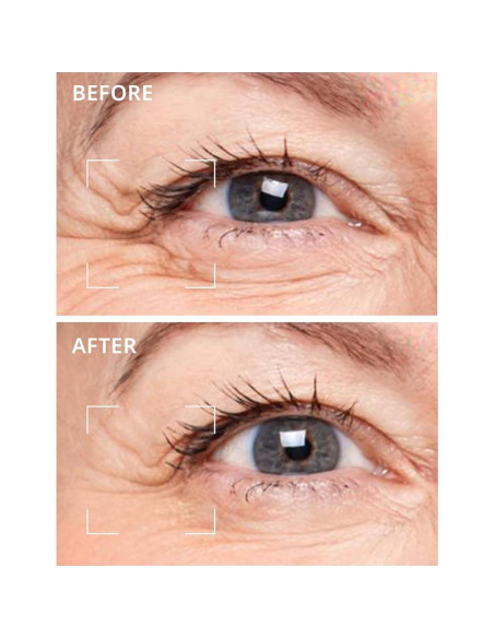 Parches para Ojos Depology Deepcare+ con Suero | 12 Pares Hidratantes