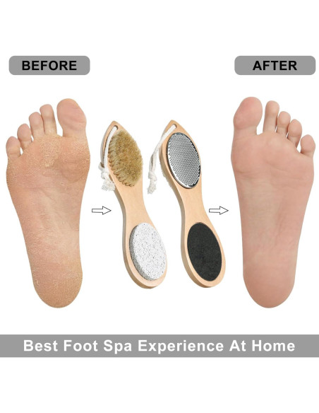 Piedra Pómez 4 en 1 Beomeen para Cuidado de Pies