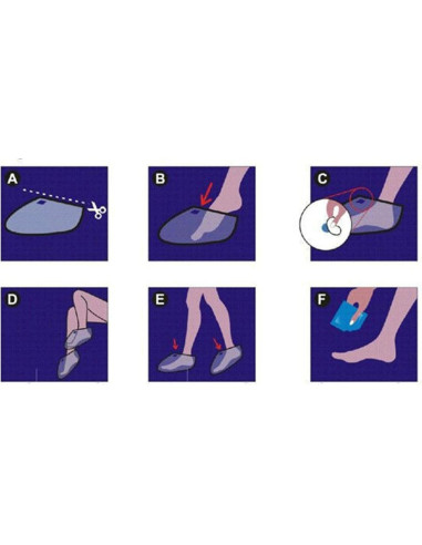 Mascarilla Exfoliante para Pies AICHUN BEAUTY - 2 Paquetes