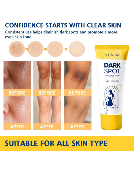 Crema Correctora de Manchas Oscuras Ashania 59.15 ml