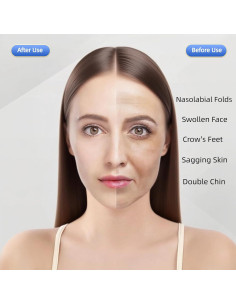 Correa para Barbilla Eavkoar - Modelador Facial en V Tamaño M 2