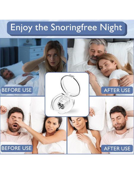 Dilatores Nasales Antisnoring Aikaplus 8PCS Transparente