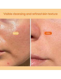 Limpiador Enzimático Refinador Kiero 50g - Facial Vegano con Papaya 2