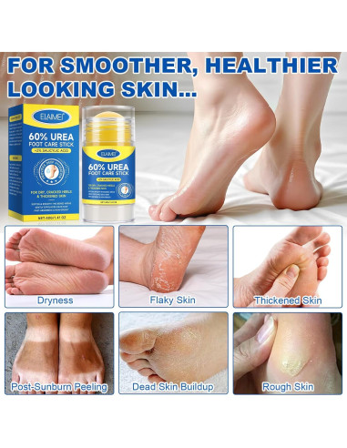 Barra Hidratante para Pies ZIXAOK 60% Urea 2% Ácido Salicílico