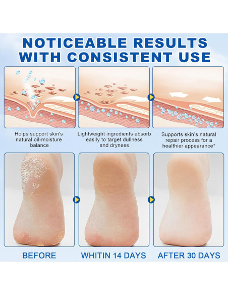 Barra Hidratante para Pies ZIXAOK 60% Urea 2% Ácido Salicílico