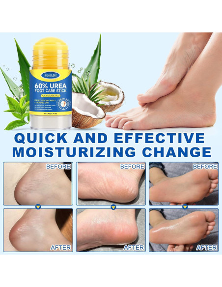 Barra Hidratante para Pies ZIXAOK 60% Urea 2% Ácido Salicílico