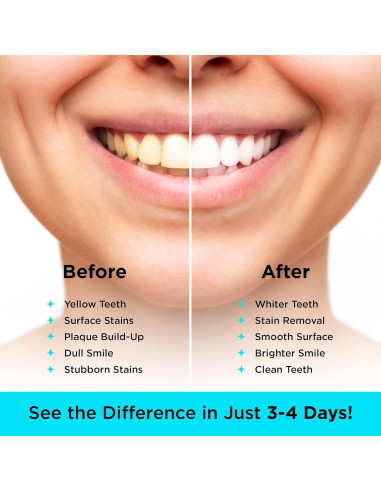 Polvo Blanqueador de Dientes Carbon White 30g - Carbón Activado