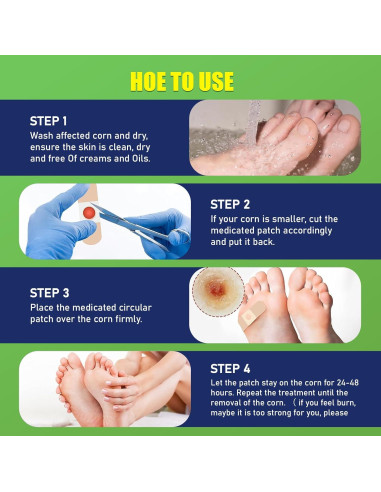 Almohadillas para Callos WABRINY - Eliminación Rápida y Efectiva, 30 Unidades