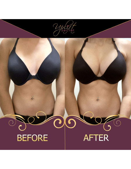 Inserciones Silicona Uplift Secret - Almohadillas Aumento Senos