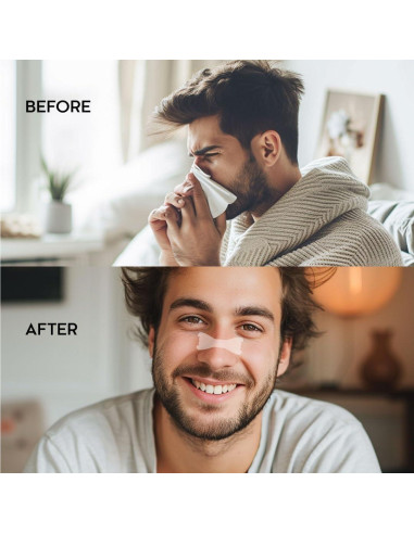 Tiras Nasales Volqi Fuerza Extra 60 Unidades Alivio Ronquidos