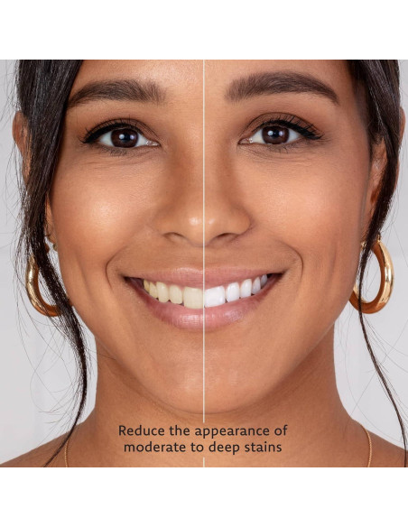 Gel Blanqueador Dental Everest VAAS 4 Jeringas 35% Peróxido