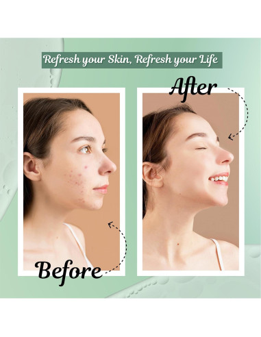 Kore Set de Cuidado de Piel Vegano - 3 Piezas con Limpiador, Tónico y Hidratante