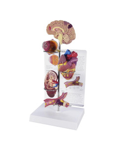 Modelo de Hipertensión GPI Anatomicals con Tarjeta Educativa