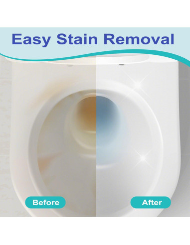 Paquete de 4 piedras pómez Gnvop con mango largo para inodoro