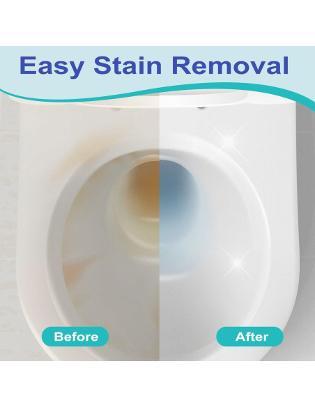 Paquete de 4 piedras pómez Gnvop con mango largo para inodoro