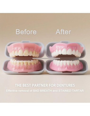 Tabletas de Limpieza Sifuland para Dentaduras y Retenedores - 30 Unidades